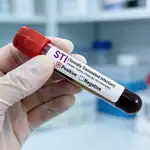 Epidemia chorób wenerycznych w Europie. Przyczyny i 17 najczęstszych chorób. Wykład nr. 239